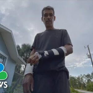 Florida Man Describes Tiger Attack That Nearly Claimed His Life