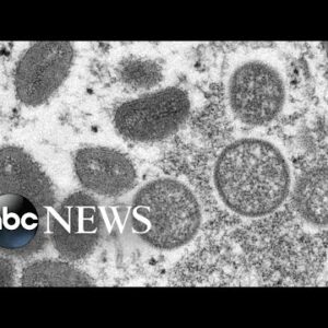7 people in the US confirmed or presumed to have monkeypox in 5 states l ABCNL