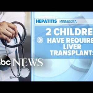 10 states report increase of severe hepatitis among children l GMA