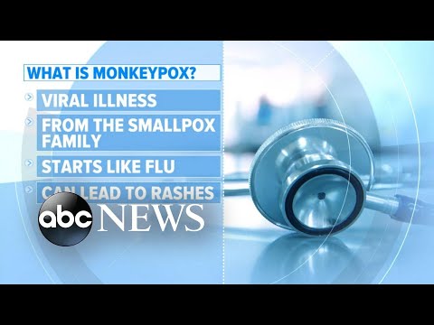 1st US case of monkeypox confirmed in Massachusetts