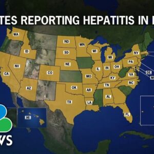 CDC Investigating Hepatitis In Children As Cases Continue To Rise