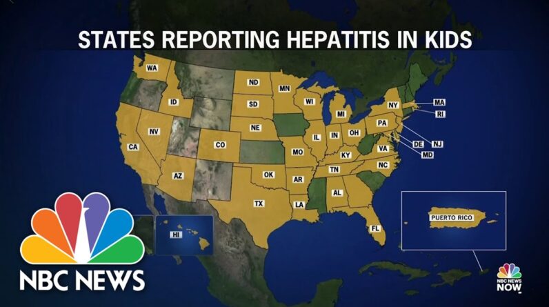 CDC Investigating Hepatitis In Children As Cases Continue To Rise