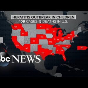 CDC issues new global alert on hepatitis cases in children | ABCNL