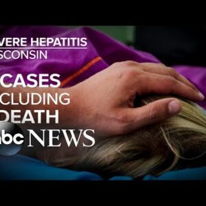 Concerns grow over hepatitis outbreak