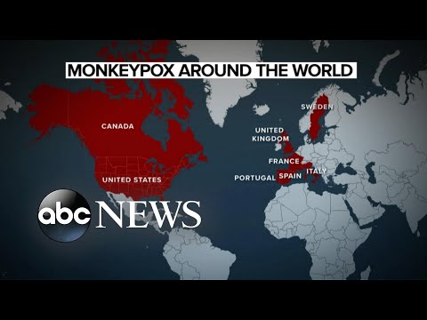Concerns over monkeypox in the United States