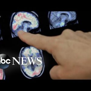FDA permits marketing of diagnostic test for Alzheimer's disease