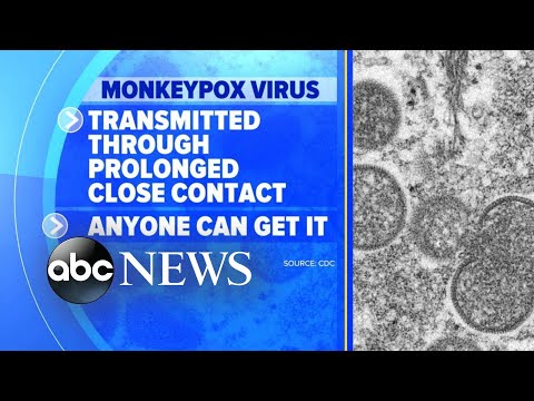 Fears of monkeypox outbreak grow as cases rise l GMA