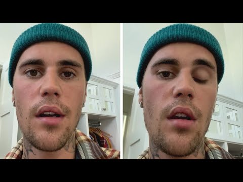 Justin Bieber Reveals His Face Is PARALYZED