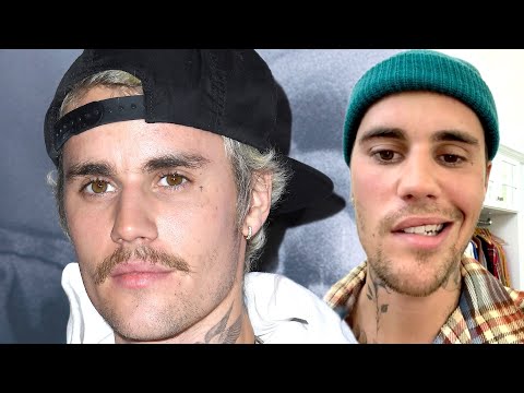 Justin Bieber Shares UPDATE After Revealing His Face Is Paralyzed